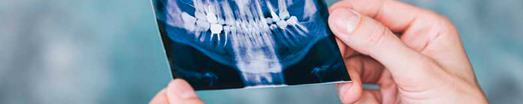 Рентген зубов в Митино
