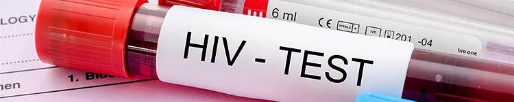 Анализы на ВИЧ в Митино